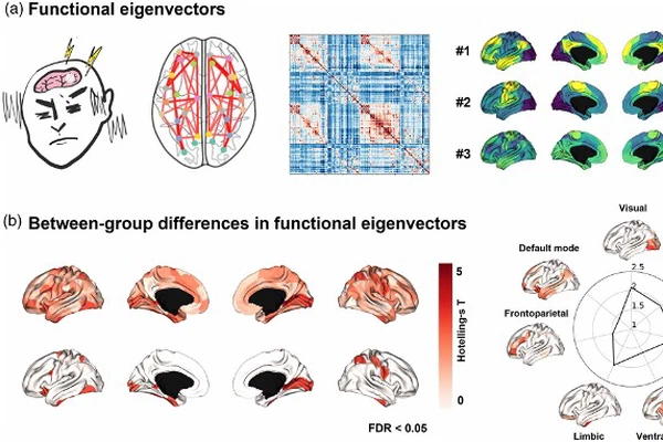 Whole-Brain Functional Gradients in Migraine